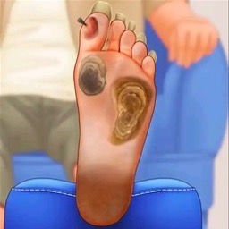 修脚足疔模拟器中文版