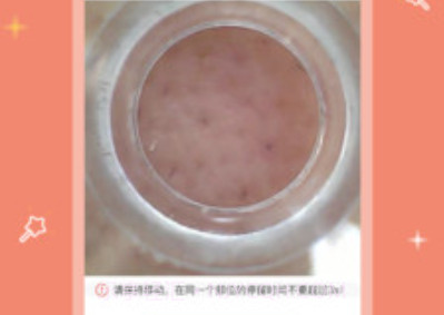 inFace护肤v2.0.6截图