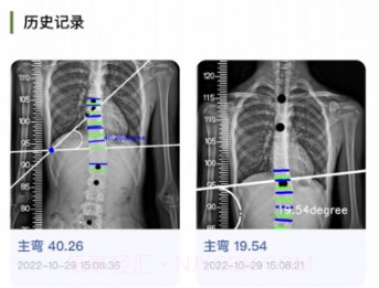 筠成矫形v1.1.7截图
