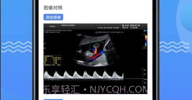 超声智库v1.2.31截图