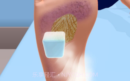 修脚游戏v4.0.17截图