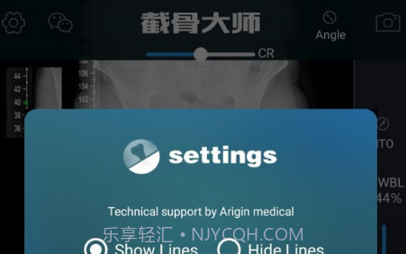 截骨大师V1.12截图