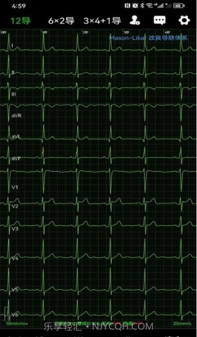 心电一张网截图4 心电一张网截图4
