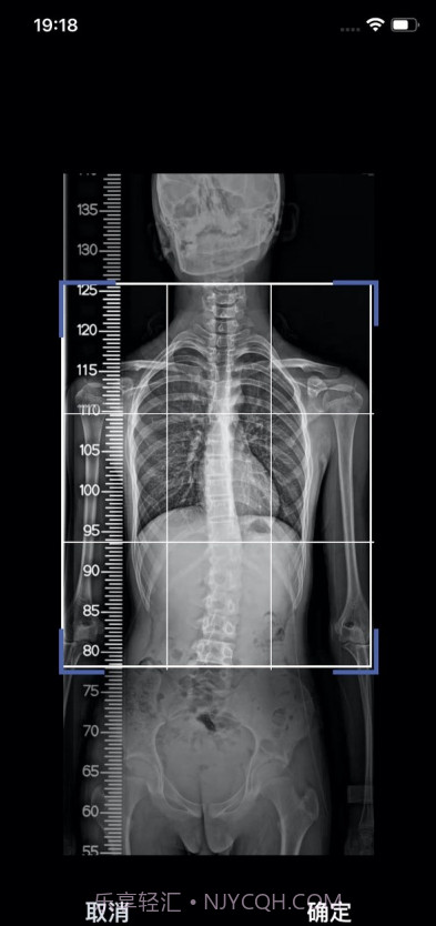 筠成矫形截图4 筠成矫形截图4