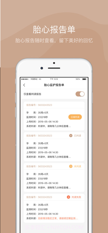 智胎心截图4 智胎心截图4