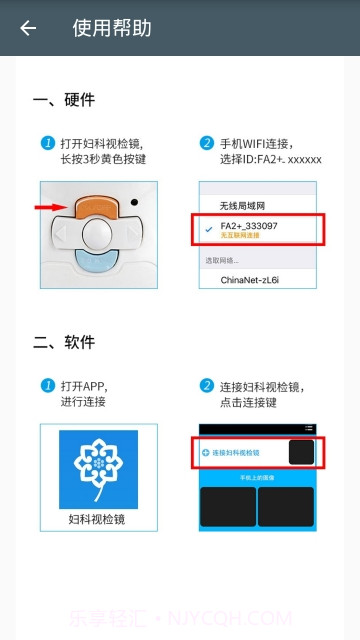 妇科视检镜截图2 妇科视检镜截图2
