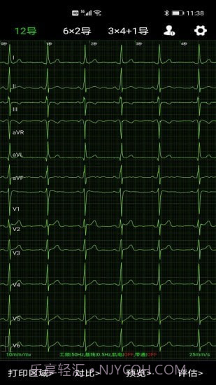 爱心电截图2 爱心电截图2