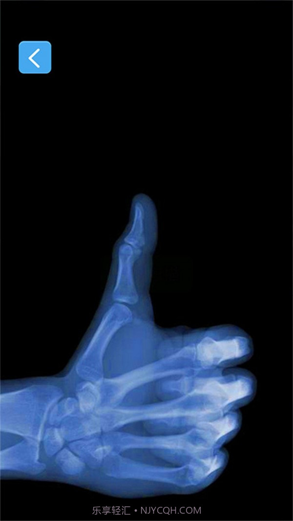 X射线模拟器截图5 X射线模拟器截图5