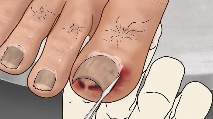 修脚足疔模拟器精简版截图1