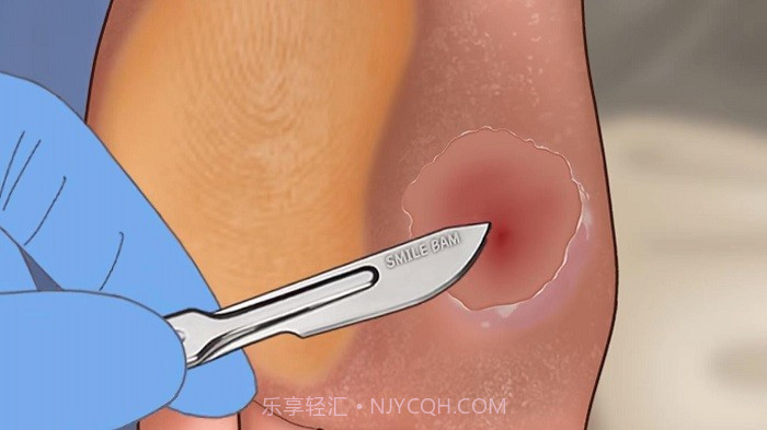 修脚足疔模拟器精简版截图3