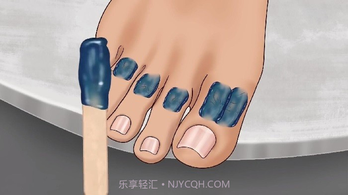 修脚足疔模拟器免广告版截图2