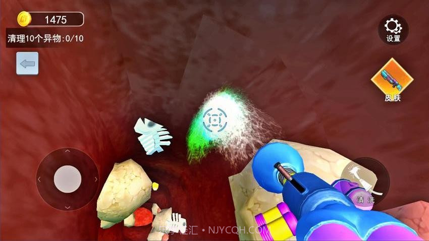 清理大肠达人官方版截图1 清理大肠达人官方版截图1